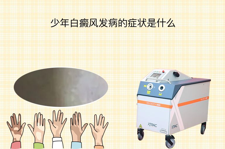 https://www.bdfsjzyy.com/d/file/p/eddb5247294a4f97f4691e42b8072fd0.jpeg