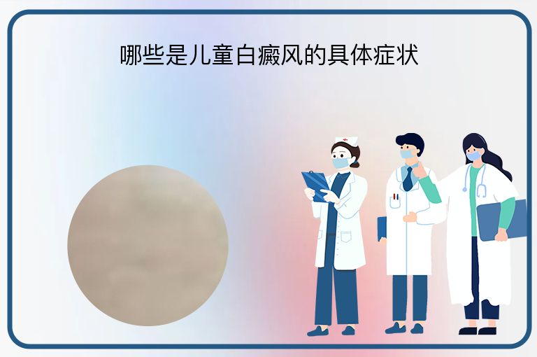 哪些是儿童白癜风的具体症状