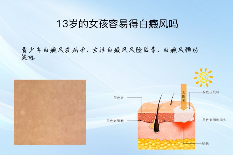 13岁的女孩容易得白癜风吗”