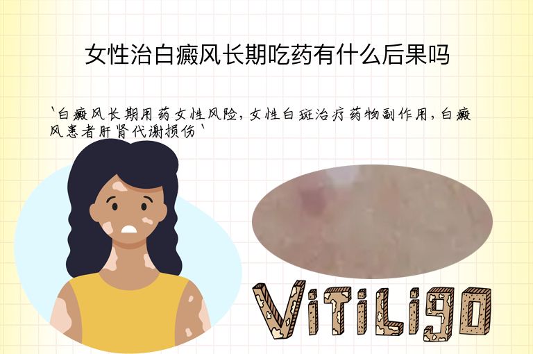 女性治白癜风长期吃药有什么后果吗”
