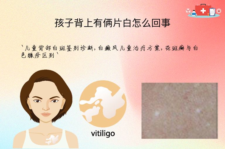 孩子背上有俩片白怎么回事