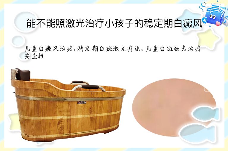 能不能照激光治疗小孩子的稳定期白癜风”