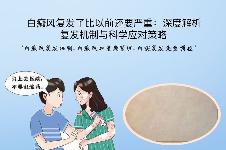 白癜风复发了比以前还要严重：深度解析复发机制与科学应对策略”