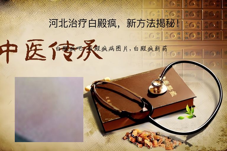 河北治疗白殿疯,新方法揭秘!”