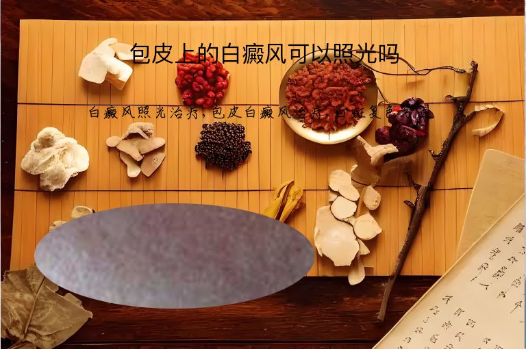 https://www.bdfsjzyy.com/d/file/p/209bb28e4fff0d55ca57f86ed453edb8.jpeg