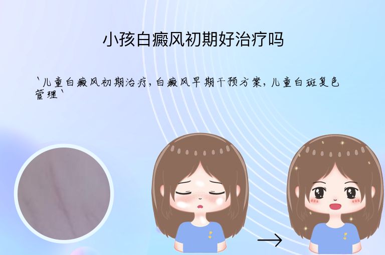 小孩白癜风初期好治疗吗