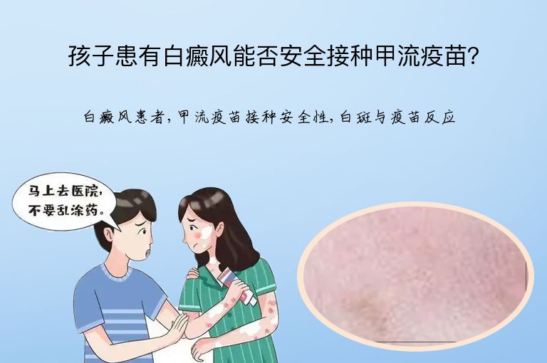 孩子患有白癜风能否安全接种甲流疫苗?”