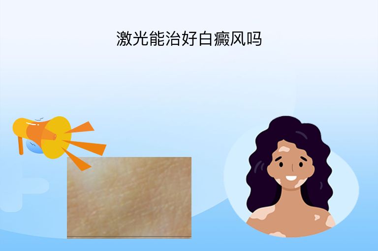 激光能治好白癜风吗”