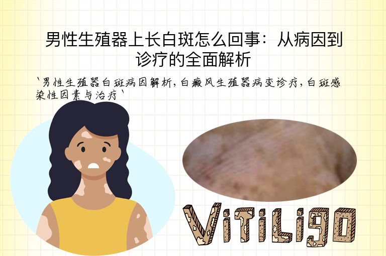 男性生殖器上长白斑怎么回事:从病因到诊疗的全面解析