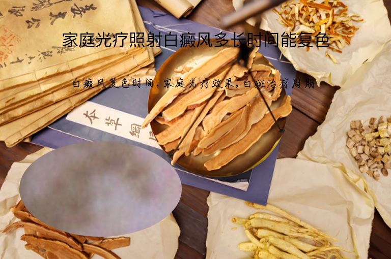 家庭光疗照射白癜风多长时间能复色”
