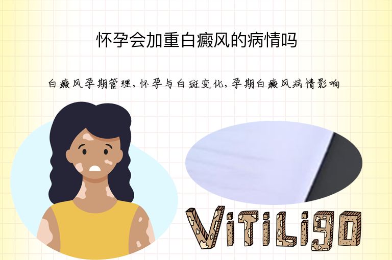怀孕会加重白癜风的病情吗”