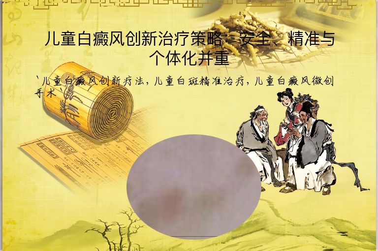 儿童白癜风创新治疗策略:安全、精准与个体化并重