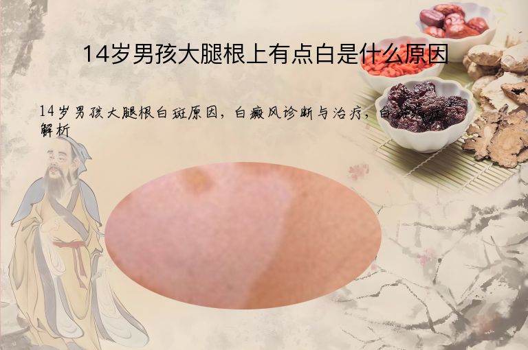 14岁男孩大腿根上有点白是什么原因”