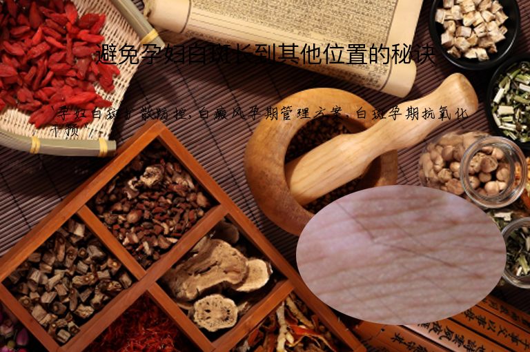 避免孕妇白斑长到其他位置的秘诀