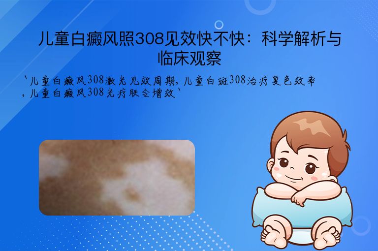 儿童白癜风照308见效快不快：科学解析与临床观察