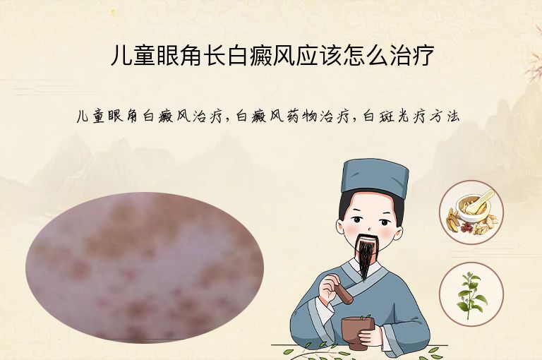 儿童眼角长白癜风应该怎么治疗”
