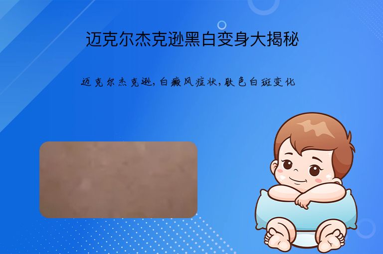 迈克尔杰克逊黑白变身大揭秘”