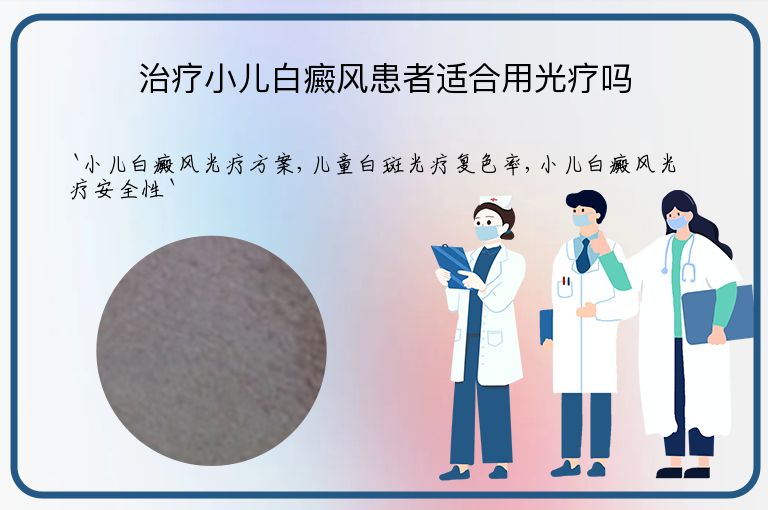 治疗小儿白癜风患者适合用光疗吗