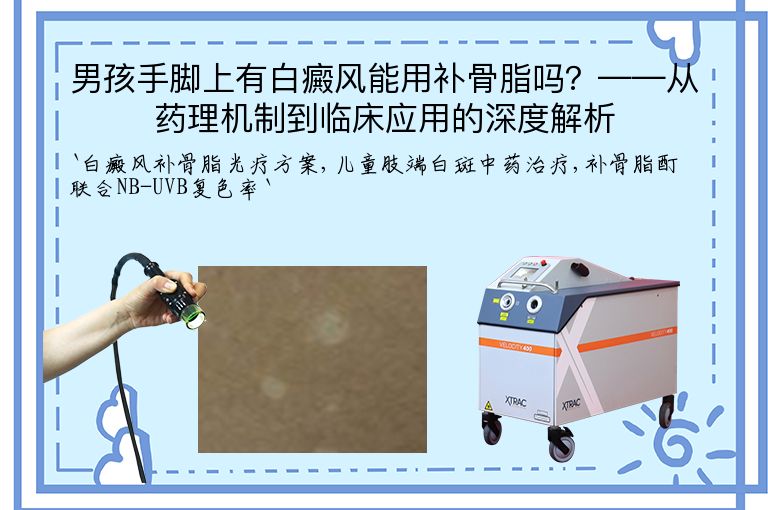 男孩手脚上有白癜风能用补骨脂吗?——从药理机制到临床应用的深度解析