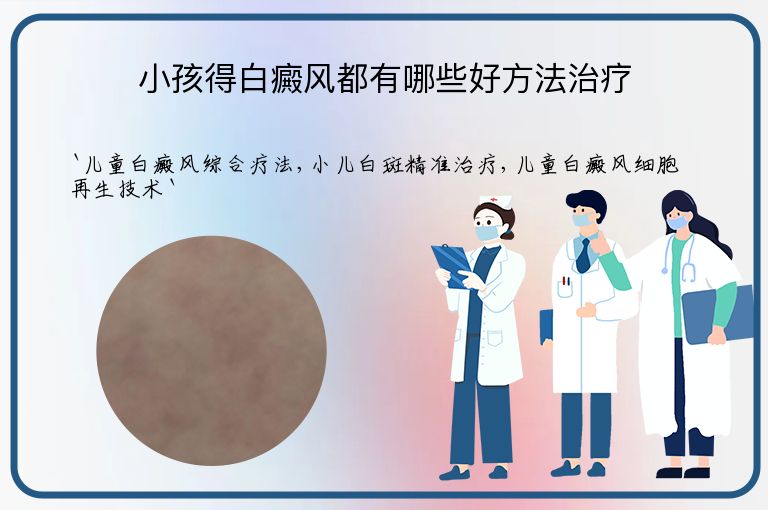 小孩得白癜风都有哪些好方法治疗”