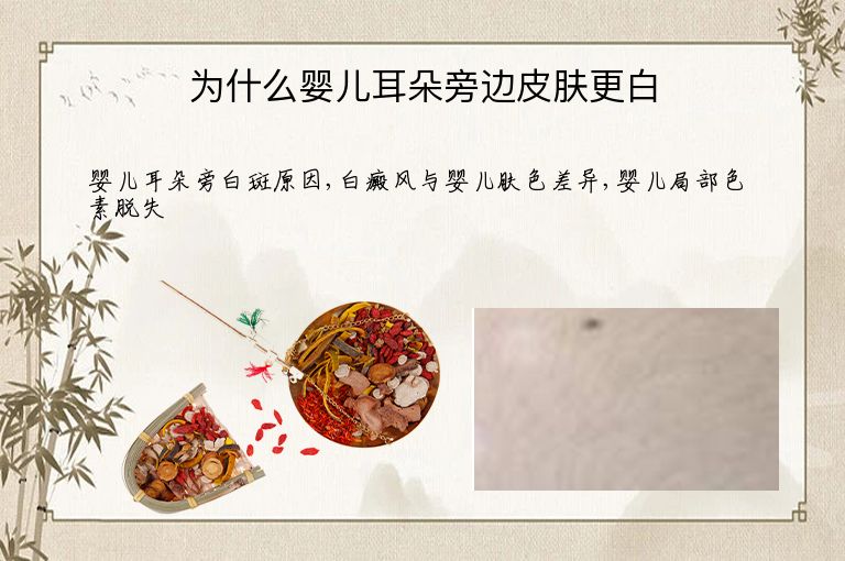 为什么婴儿耳朵旁边皮肤更白”