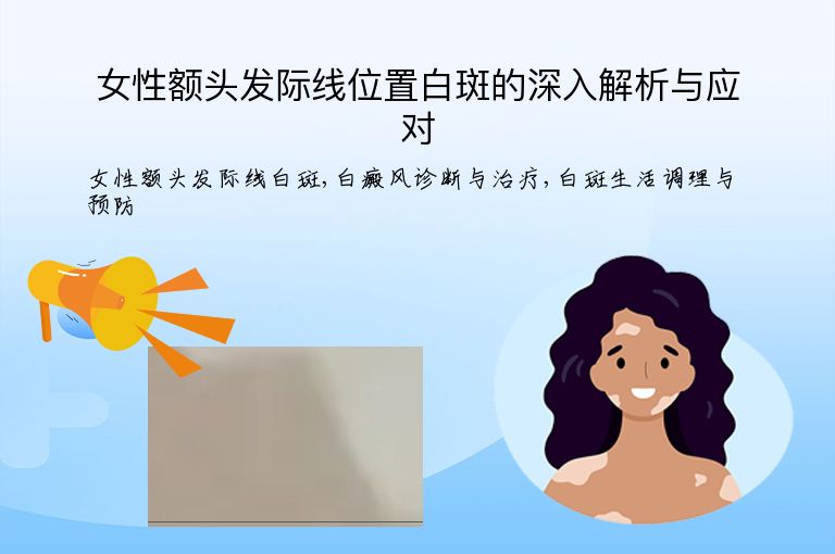 女性额头发际线位置白斑的深入解析与应对”