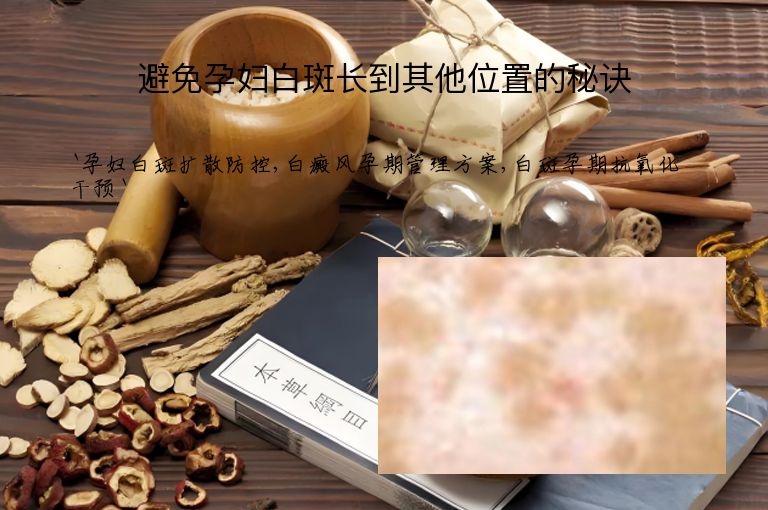 避免孕妇白斑长到其他位置的秘诀