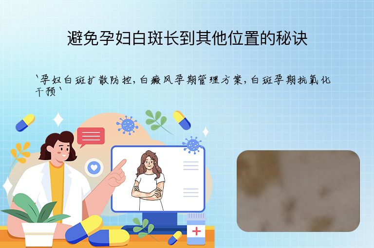 避免孕妇白斑长到其他位置的秘诀