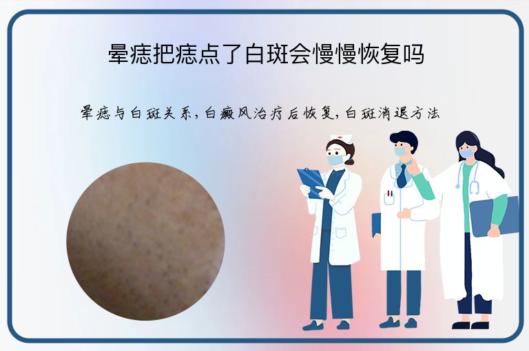 晕痣把痣点了白斑会慢慢恢复吗”