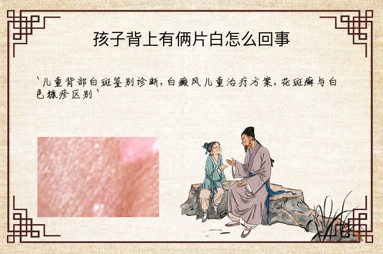 孩子背上有俩片白怎么回事