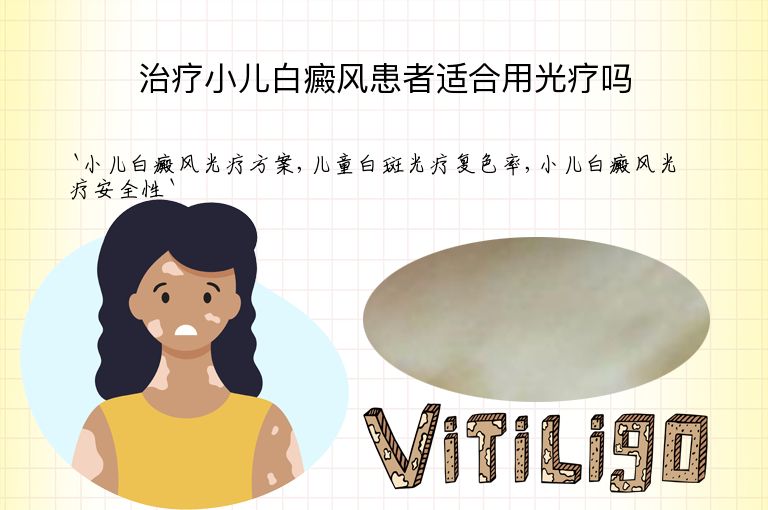 治疗小儿白癜风患者适合用光疗吗