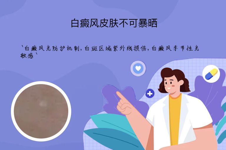 白癜风皮肤不可暴晒