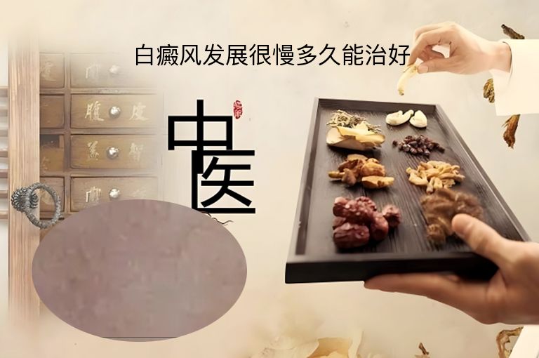白癜风发展很慢多久能治好”