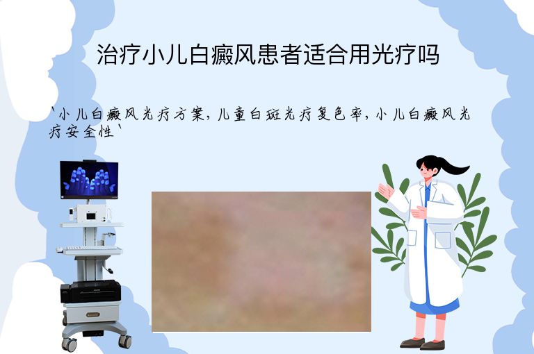 治疗小儿白癜风患者适合用光疗吗