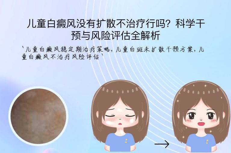 儿童白癜风没有扩散不治疗行吗?科学干预与风险评估全解析