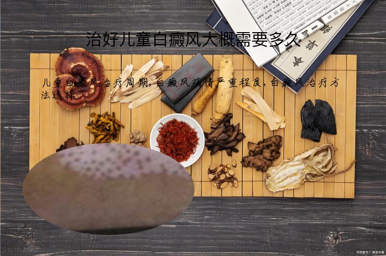 治好儿童白癜风大概需要多久”