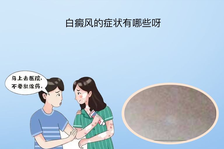 https://www.bdfsjzyy.com/d/file/p/6d1163eff5b5144a9584a086436aaf1d.jpeg