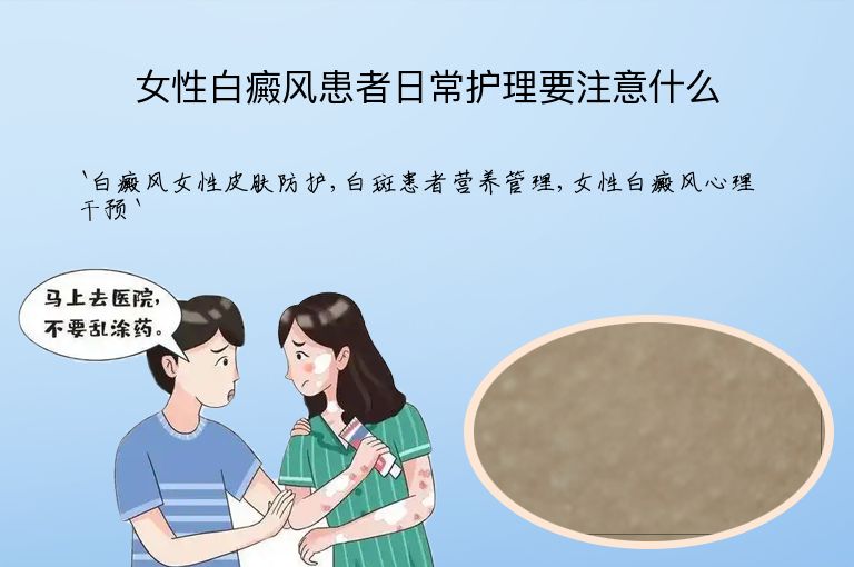 女性白癜风患者日常护理要注意什么”