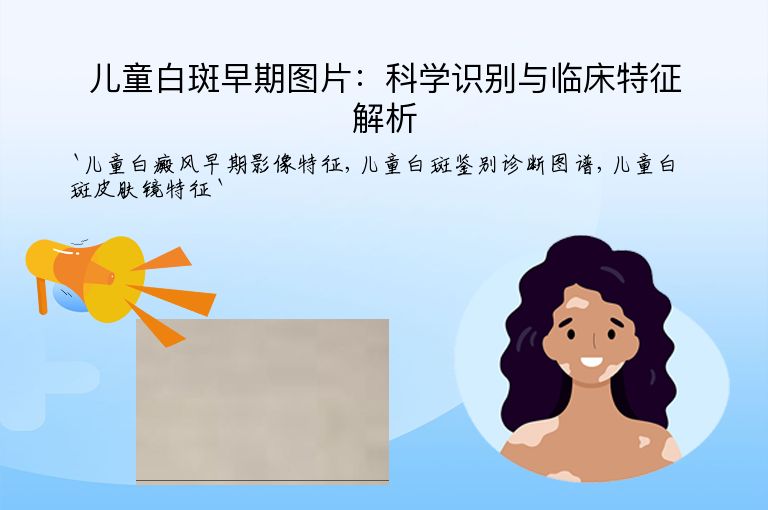 儿童白斑早期图片：科学识别与临床特征解析