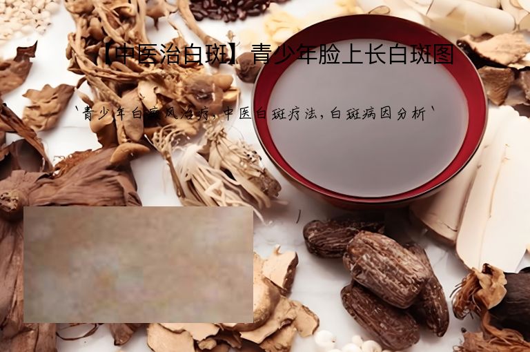 【中医治白斑】青少年脸上长白斑图”