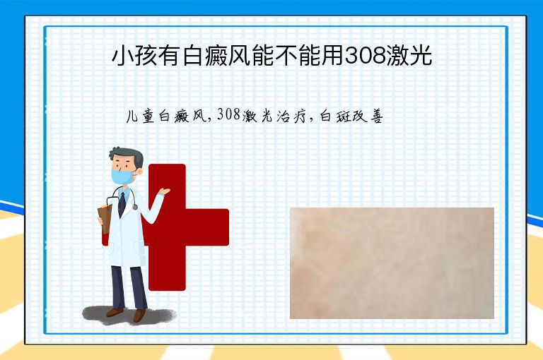 小孩有白癜风能不能用308激光”