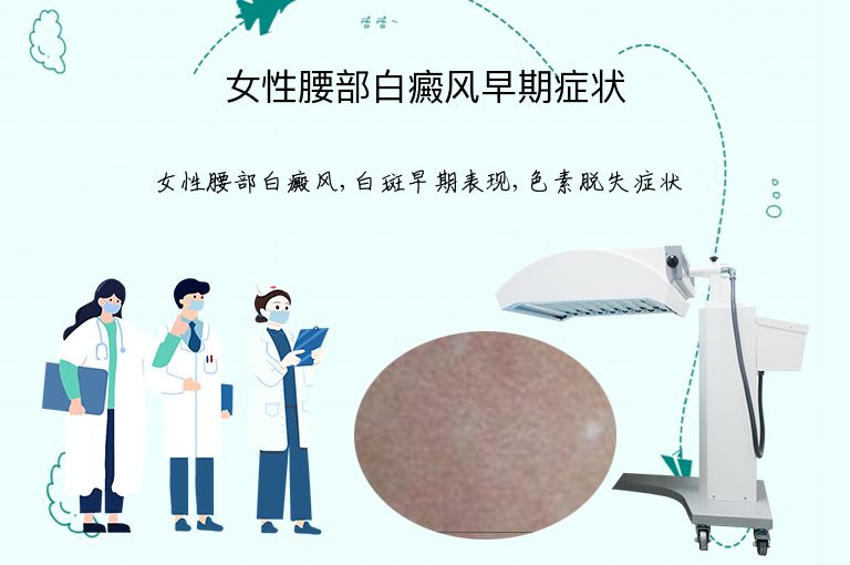女性腰部白癜风早期症状”