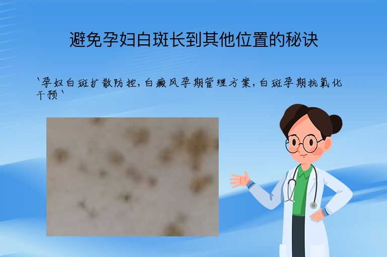 避免孕妇白斑长到其他位置的秘诀