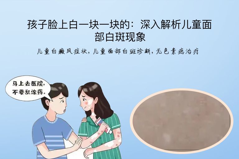 孩子脸上白一块一块的：深入解析儿童面部白斑现象”