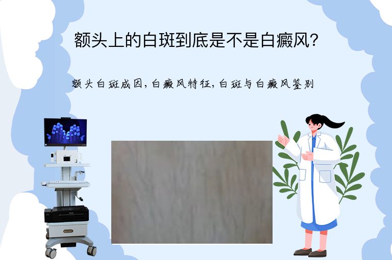 额头上的白斑到底是不是白癜风？”