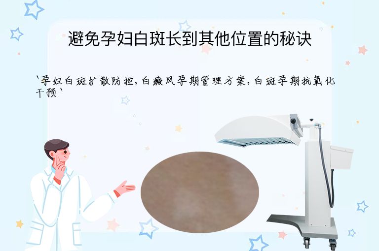避免孕妇白斑长到其他位置的秘诀
