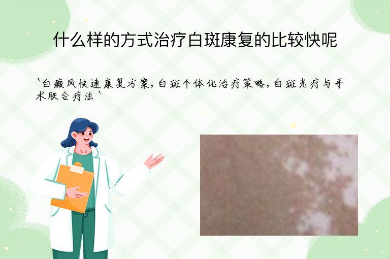什么样的方式治疗白斑康复的比较快呢