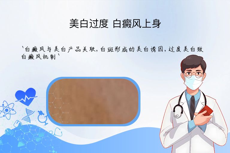 美白过度 白癜风上身”