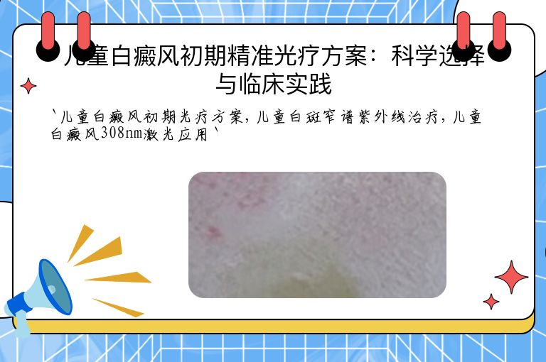 儿童白癜风初期精准光疗方案：科学选择与临床实践