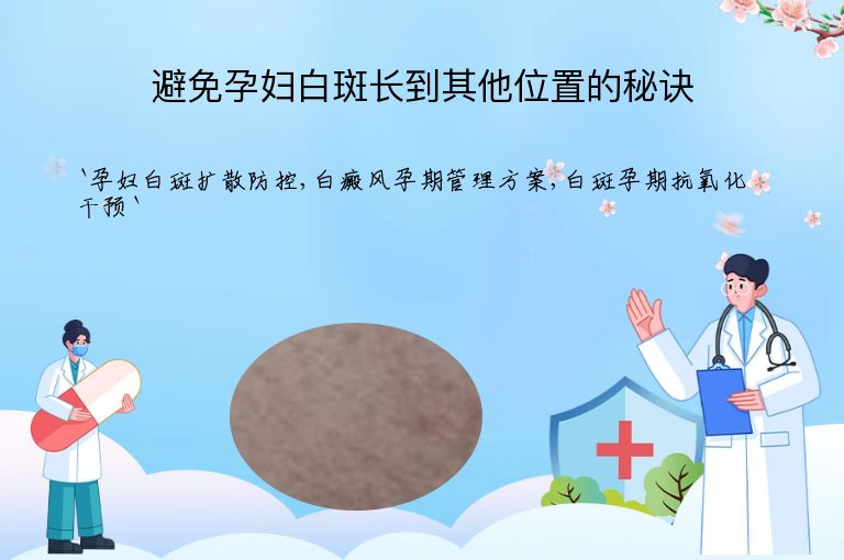 避免孕妇白斑长到其他位置的秘诀